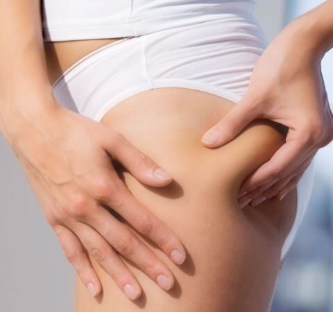 My Secrets Of How To Prevent Cellulite Revealed